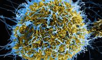 Kenya reports more Ebola cases, all linked to initial patient