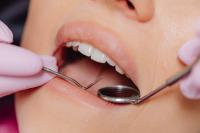 Changes to Dentistry Under Croatian Health Insurance Fund
