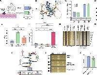 Staphylococcus aureus wall teichoic acid structure dictates virulence potential and resistance to host defenses