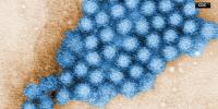 Health department declares norovirus outbreak over at metro area elementary school