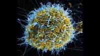 Ebola spreads to Nigeria and Kenya as epidemic expands beyond Congo (DRC)