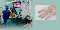 China Approves Nation’s First Brainstem Implant for Deafness