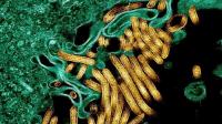 Health Ministry heightens Ebola surveillance after outbreaks in DRC, Kenya, Nigeria
