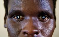 African Union Development Agency and Sightsavers join forces to fight neglected diseases