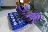 Africa faces ‘complex’ Ebola outbreak after spread to Nigeria: WHO