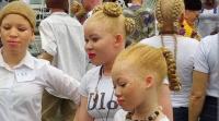 Nigeria demands protection for people with albinism, leprosy