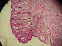 Can musical frequencies destroy liver cancer tumours? [VIDEO]