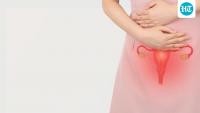 Can Ayurveda treat ovarian cysts? Expert explains root-cause approach
