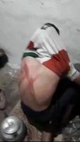 Afghan Migrants Allege Beatings and Torture by Turkish Border Forces