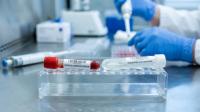 Costa Rica records 2,954 cases of syphilis and a 12% increase in patients with gonorrhea