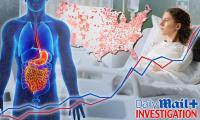 America's young cancer explosion laid bare: Major Daily Mail investigation reveals zip codes where under-50s are worst hit... why 4 specific cancers are rising fast... and what the world's top scientists believe is actually causing the crisis
