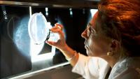 Do Italian Women Really Have Fewer Mammograms?