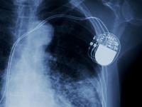 Trelleborg to exhibit innovations for medical components and devices at COMPAMED 2026