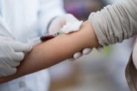 The Pacific and HIV: A chance to turn the tide — Eamonn Murphy, Saia Ma’u Piukala, Pio Smith, Beate Trankmann and Delphine Schantz