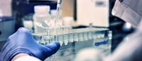 Scientists May Be Able To Stop Brain-Eating Amoeba In Its Tracks Before It Kills You