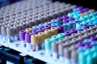 UK Care Home Gets First Lab-Free PCR Test That Reads UTI Resistance Genes in 60 Minutes