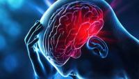 World Stroke Day 2026: Stroke no longer just an elderly concern, doctors warn against ignoring early signs