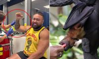 Australian's Bali trip takes a terrifying turn after bat sinks its teeth into his arm
