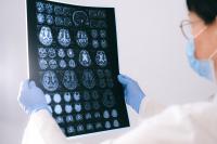 Egyptian Blue Nanosheets Track Living Brain Immune Cells in Real Time, Swiss Study Finds