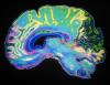 Healthier lifestyle choices could mitigate telomere length-associated brain disease risks