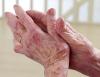 Study shows how the immune system behaves throughout pregnancy