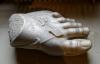 The Story Behind the “Greek Foot” and Its Medical Explanation